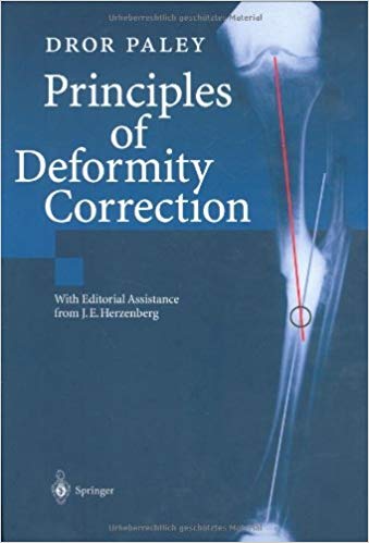 Paley Principles Of Deformity Correction Pdf - Download Free Apps